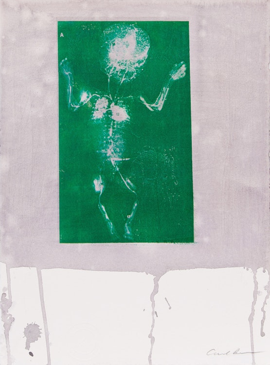 Artwork by Carl Beam, Ultrasound